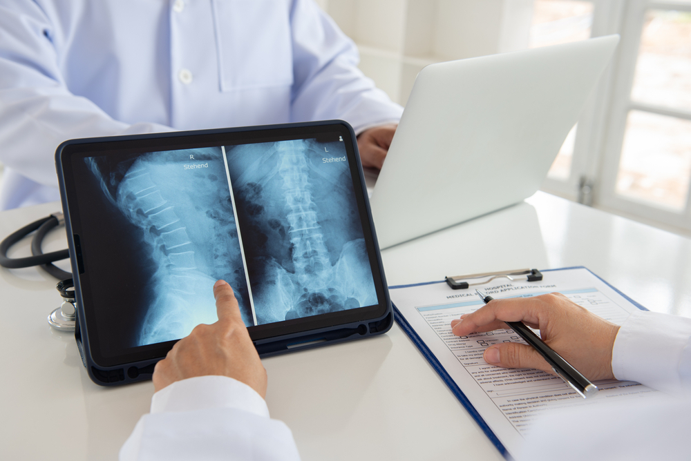 Understanding Spine Health